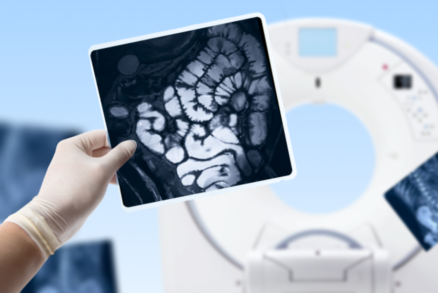 Комплекс МРТ "Причина боли в кишечнике"