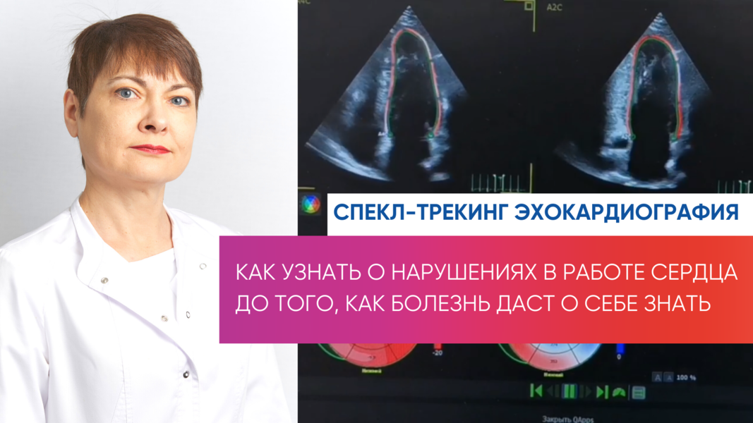 Эхокардиография комплексная с оценкой продольного глобального стрейн